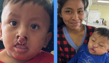 Local medical team returns home after providing life-changing care in Guatemala