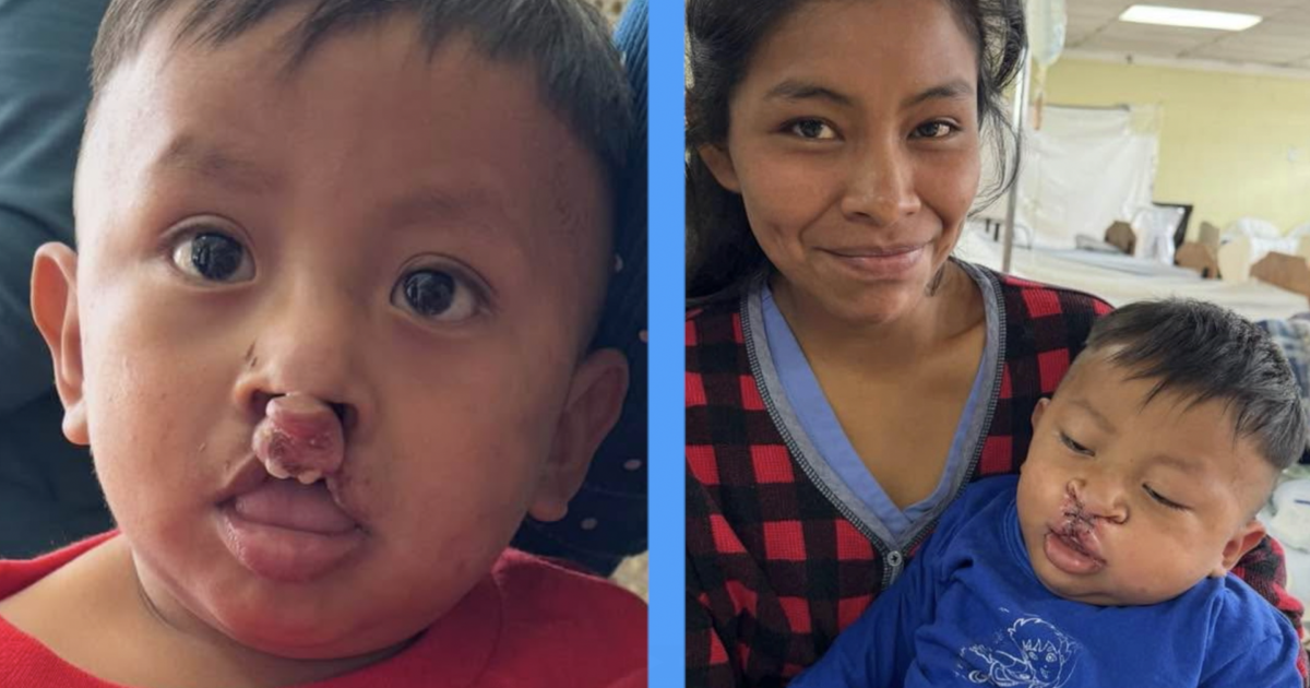 Local medical team returns home after providing life-changing care in Guatemala