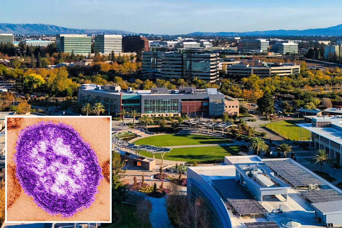 Measles case found in California after they passed through San Francisco Airport
