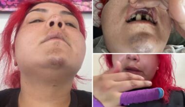 World Cup fan brutally attacked by robber after SoCal watch party