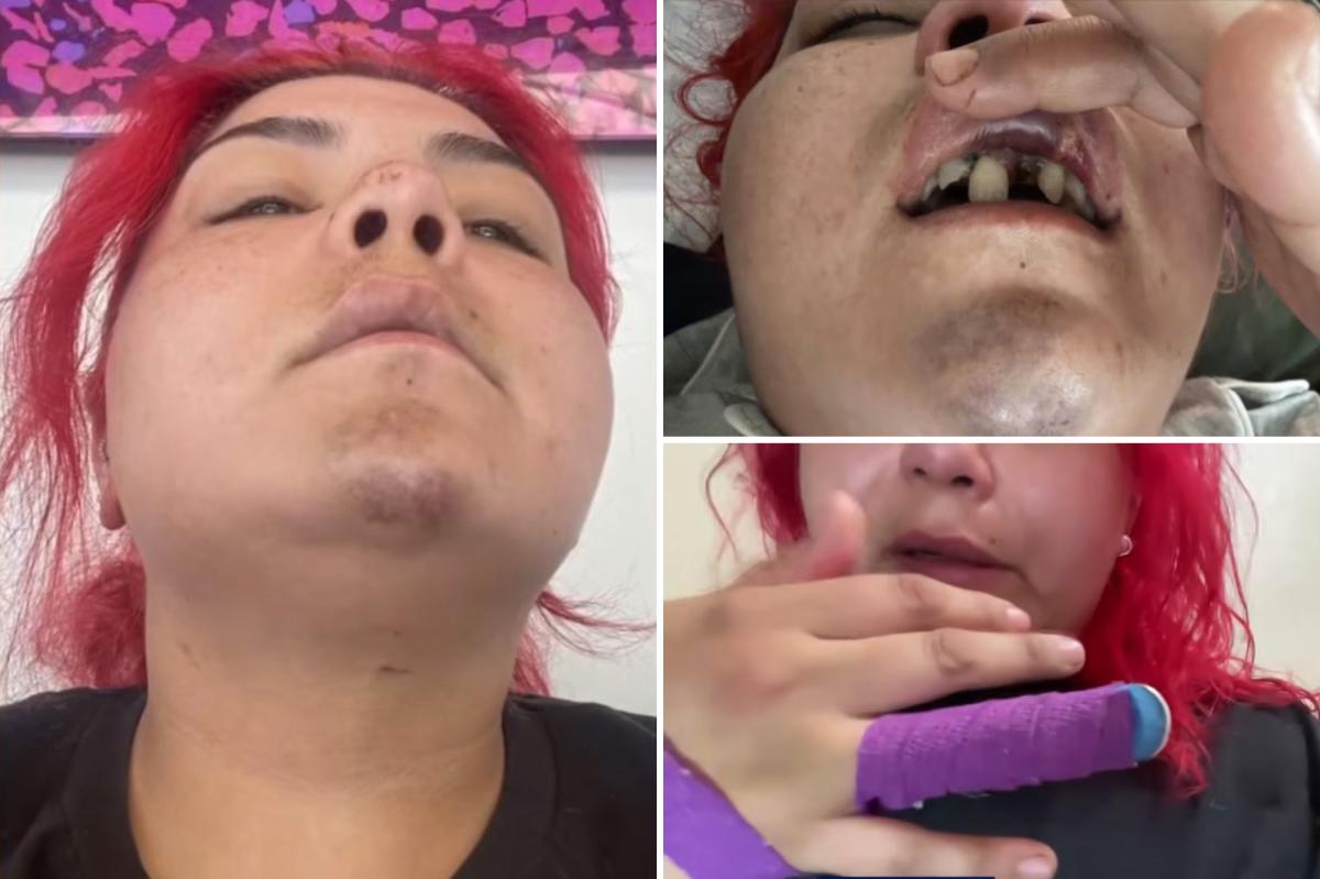 World Cup fan brutally attacked by robber after SoCal watch party