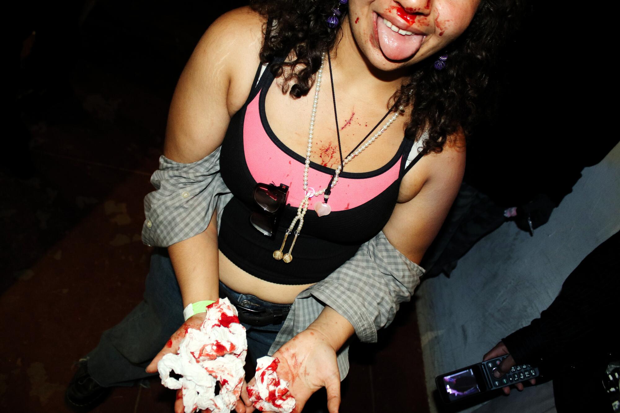 Angela, 19, was in the mosh pit when she was accidentally struck in the nose by another concertgoer on April 3, 2026.