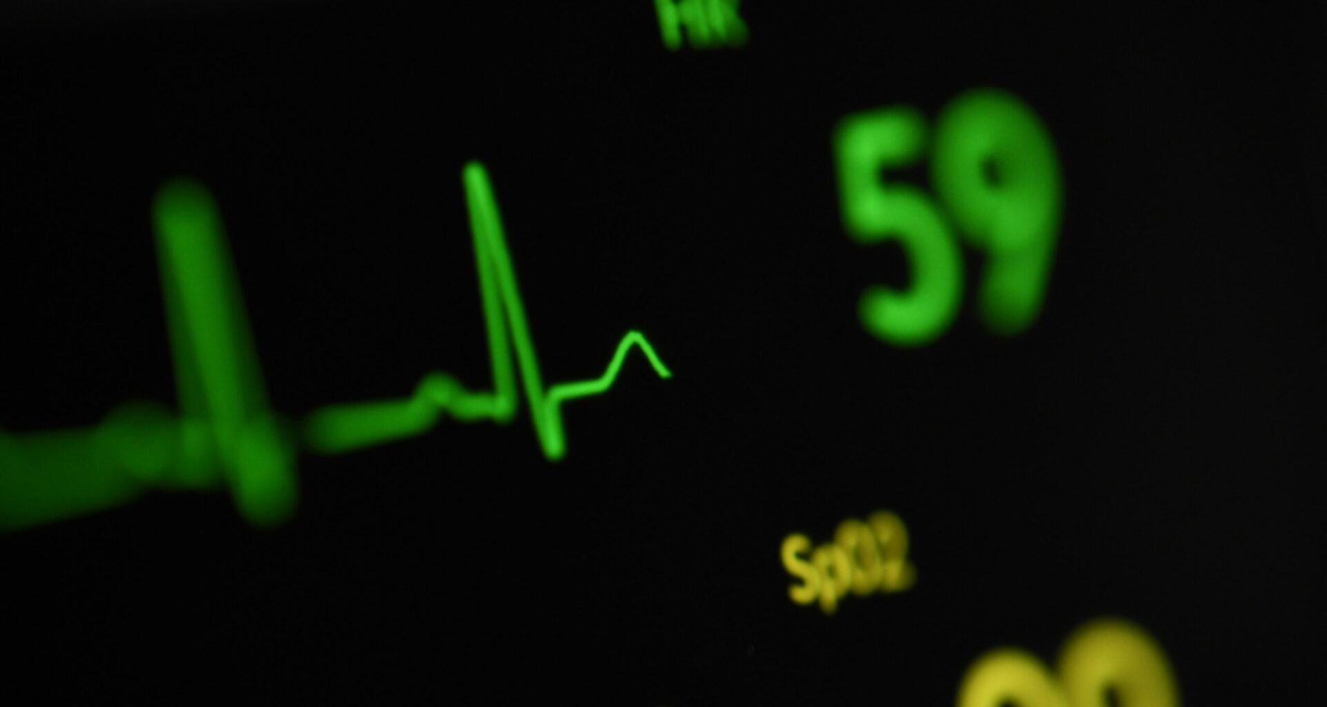 A close-up photo showing an EKG line, with a spike up and wavy lines after, adjacent to numbers showing heart rate.