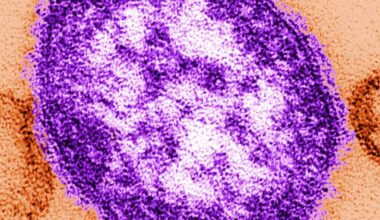 Sacramento, Placer measles outbreak declared over by counties