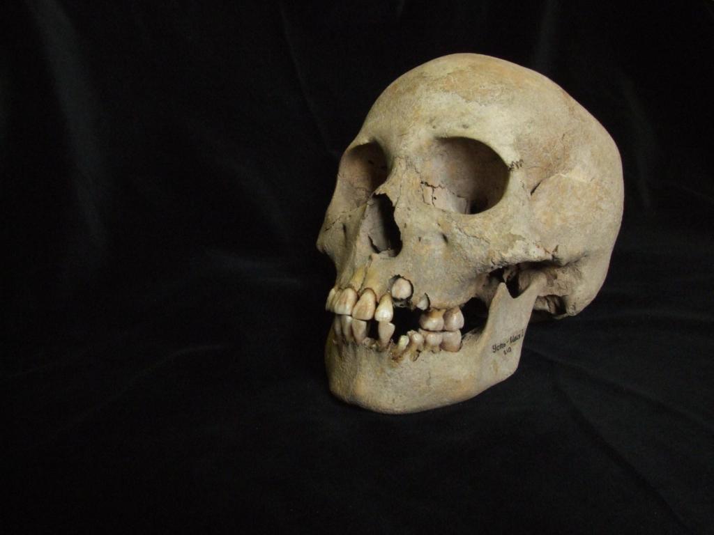 Ancient teeth rewrite plague’s timeline, dating back 5,500 years ago