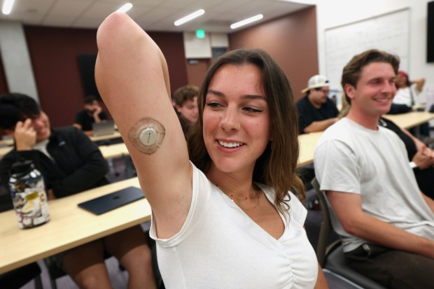 Student Rylan Breneman shows her Dexcom continuous glucose monitor while attending the Metabolic Health Analytics class at UCSD in La Jolla on Tuesday, June 02, 2026. (Hayne Palmour IV / For The San Diego Union-Tribune)