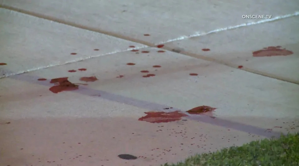 Long Beach stabbing suspect