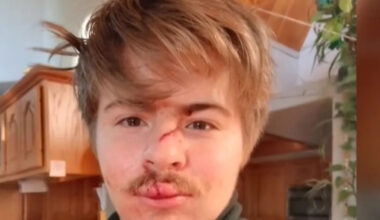 Bear Pushes Through Bedroom Window Screen and Injures 19-Year-Old Inside California Home