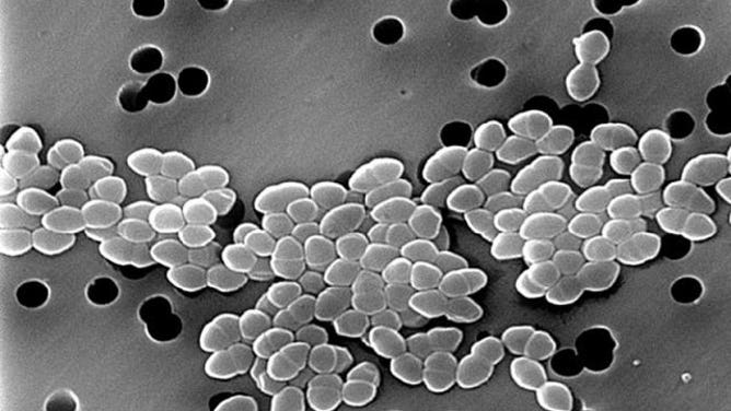 Scanning electron micrograph of enterococci.