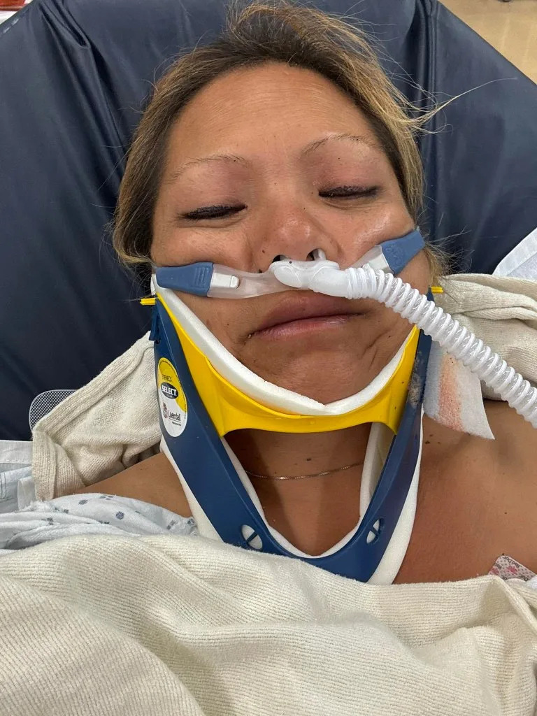 Cadotte in the hospital after the freak ocean accident in Pacifica, Northern California. Facebook/@lilia.cadotte