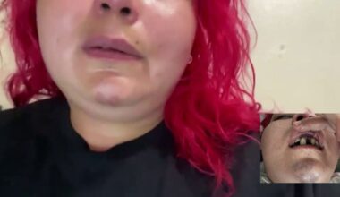 Mom of 2 says she was beaten, robbed after leaving a restaurant's World Cup watch party in Long Beach