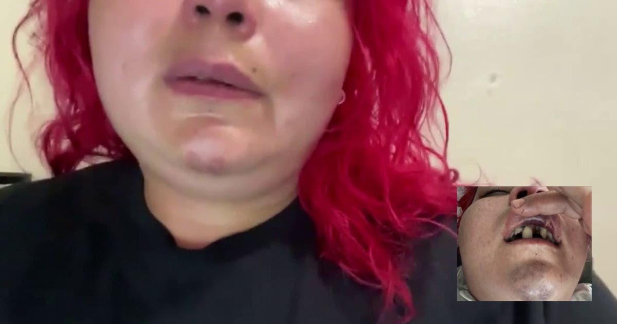 Mom of 2 says she was beaten, robbed after leaving a restaurant's World Cup watch party in Long Beach