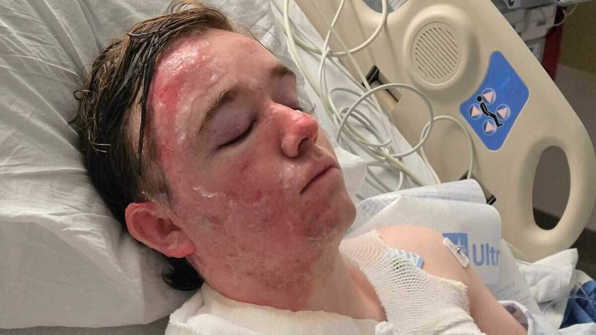 Yuba City fast food worker in hot oil attack thanks supporters