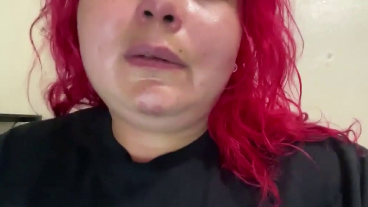 Woman says she was beaten, robbed in Long Beach