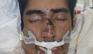 LACo Health Seeks Public's Help Identifying Patient