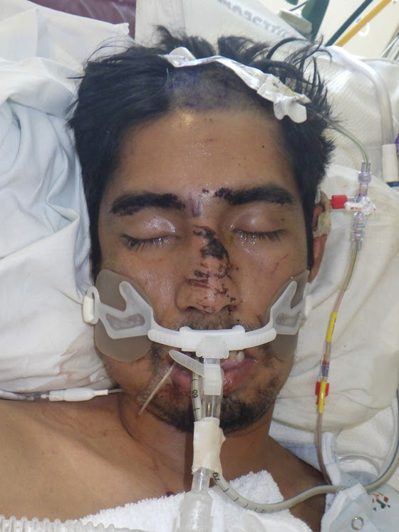 LACo Health Seeks Public's Help Identifying Patient