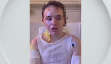 Yuba City McDonald's employee burned with hot cooking oil thanks supporters from hospital bed