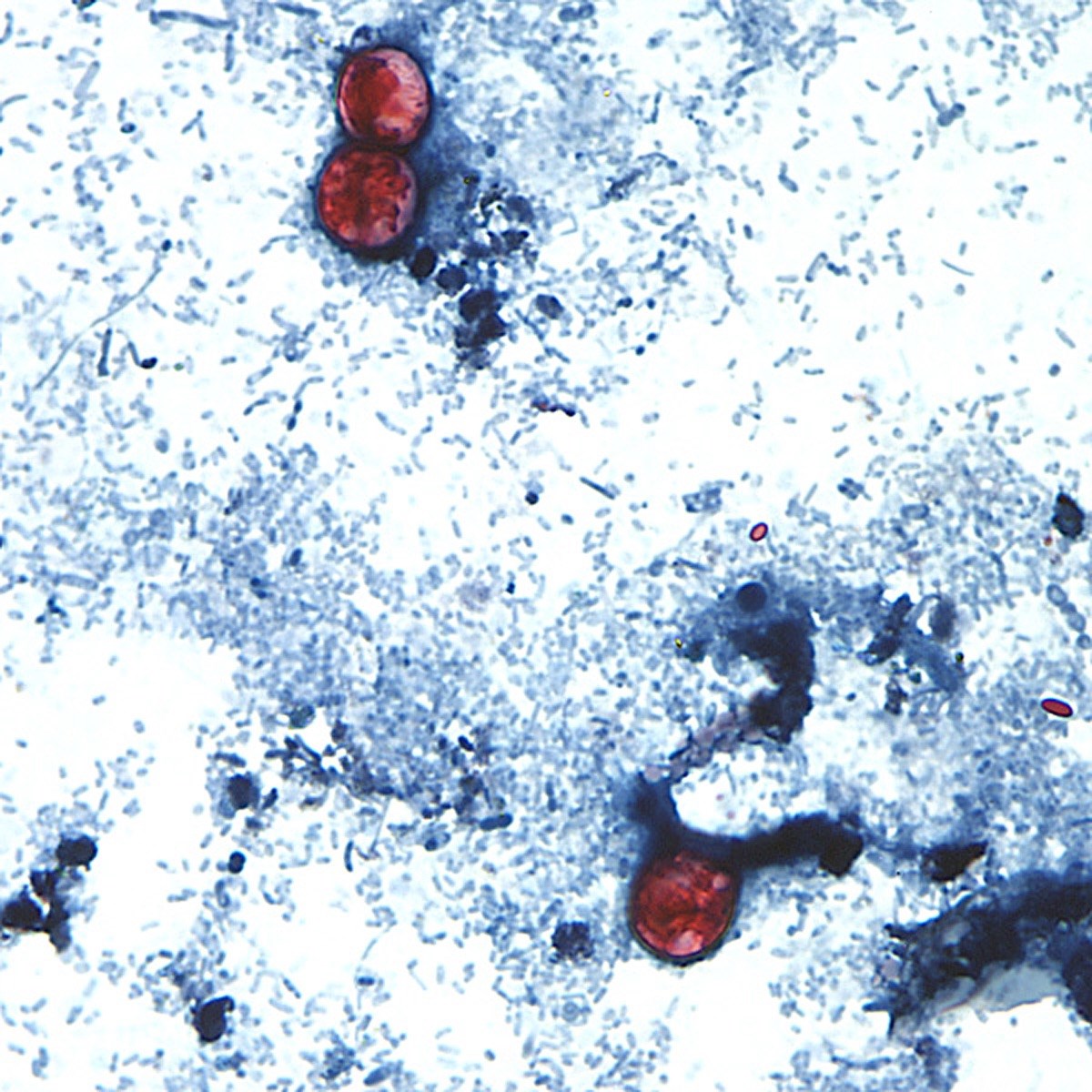 This undated photo taken through a microscope provided by the CDC shows Cyclospora cayetanensis oocysts found in a fresh sample.