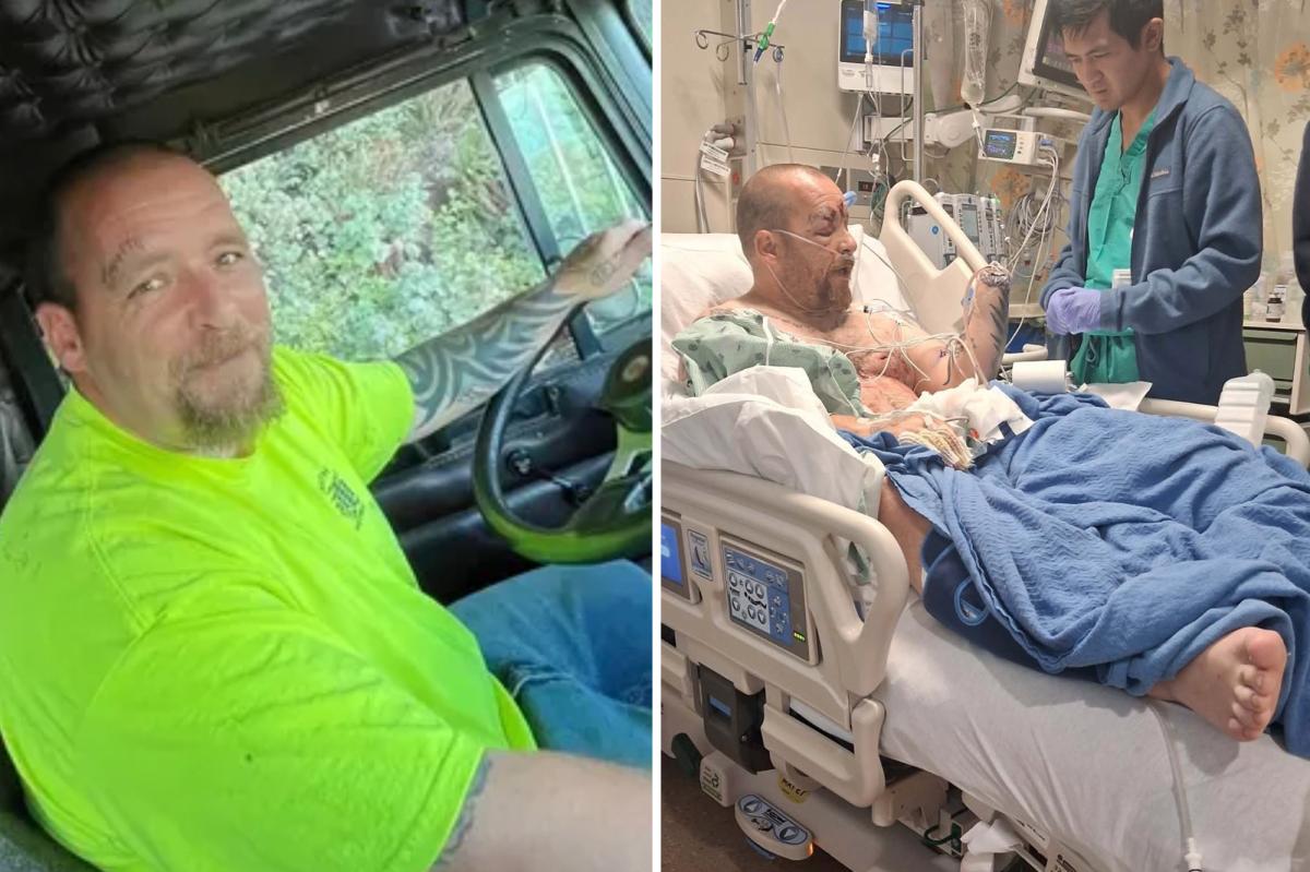 California man loses hand after ‘homemade firework’ explodes at beach