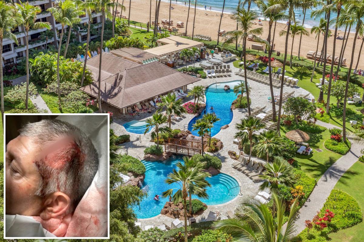 3 teen boys arrested in bloody 'anti-white' attack on California family at Hawaii resort