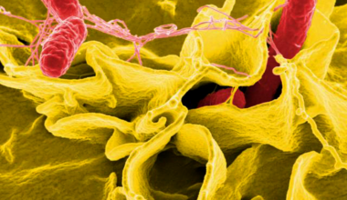 Salmonella bacteria in red and yellow