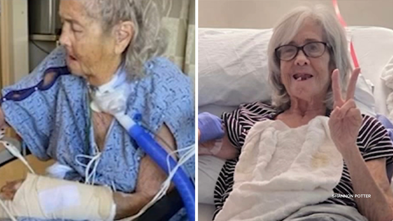 Seal Beach woman struck by teen on e-motorcycle advocates for safety and accountability