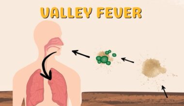 Inspire Health launches Valley Fever Care Program to expand treatment