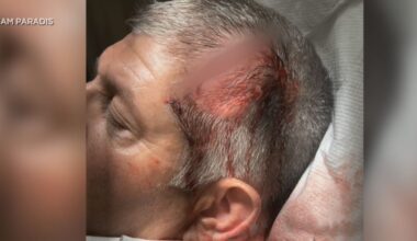California family ‘totally overwhelmed’ after large fight at Kaanapali resort