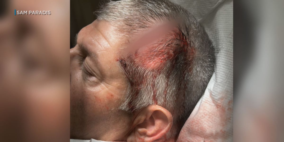 California family ‘totally overwhelmed’ after large fight at Kaanapali resort