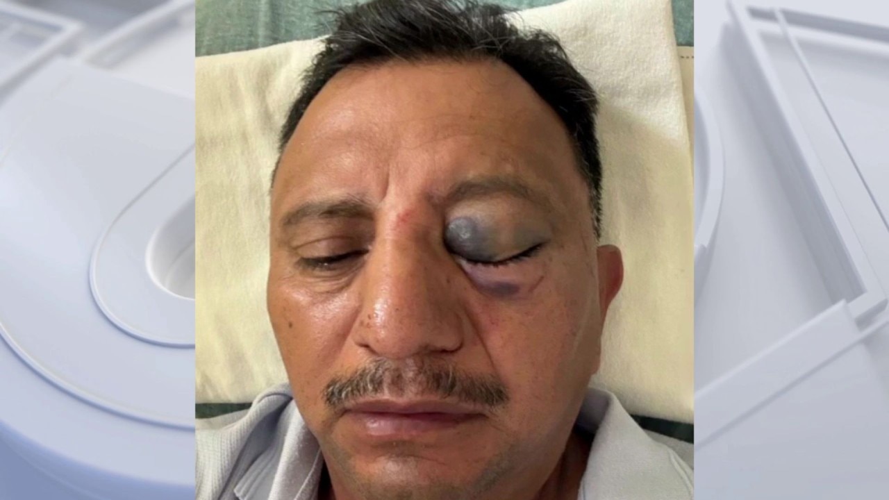 Street vendor says he was brutally attacked on July 4