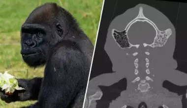 Gorilla Gets 1st-Of-Its-Kind Surgery From UC San Diego Team, | Newsradio 600 KOGO
