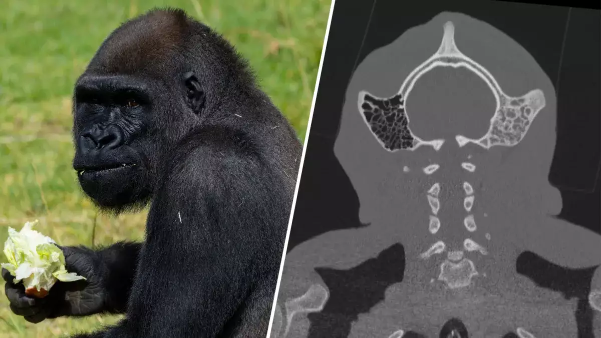 Gorilla Gets 1st-Of-Its-Kind Surgery From UC San Diego Team, | Newsradio 600 KOGO