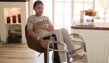 California teen recovering from severe burns after house fire needs help with rehabilitation