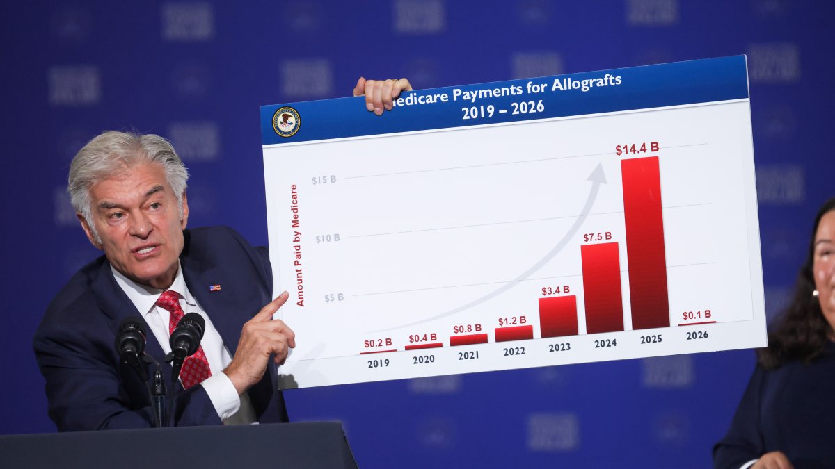 Trump admin to defer $1B in Medicaid payments to CA – NBC Los Angeles
