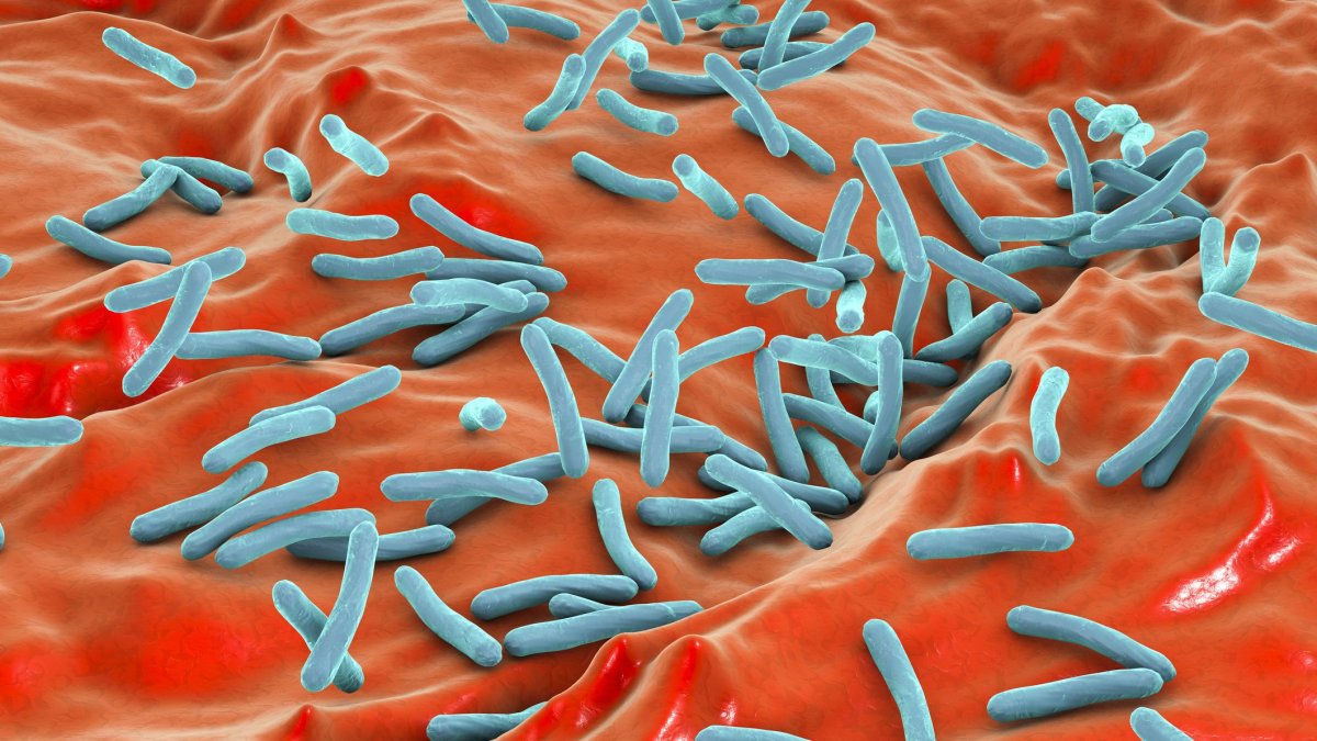 CSU San Marcos, NCTD Sprinter exposed to tuberculosis – NBC 7 San Diego