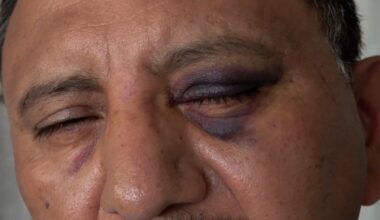 Street vendor says he was attacked in Long Beach on July 4
