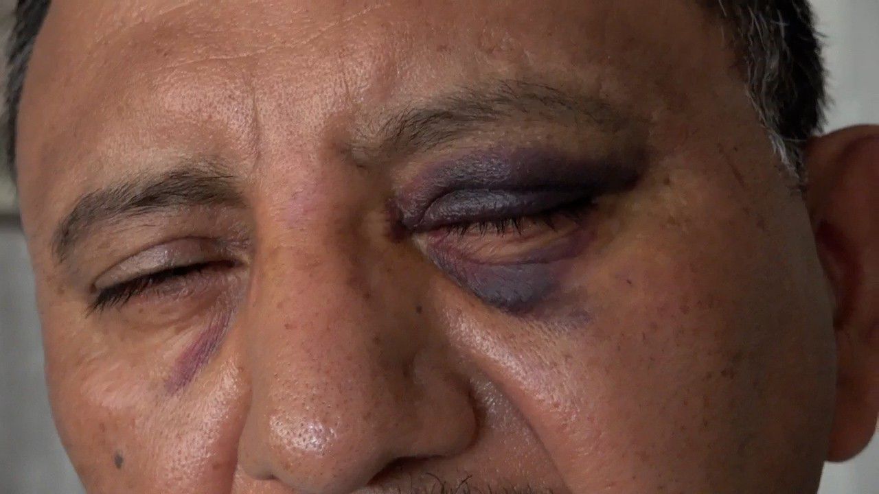 Street vendor says he was attacked in Long Beach on July 4