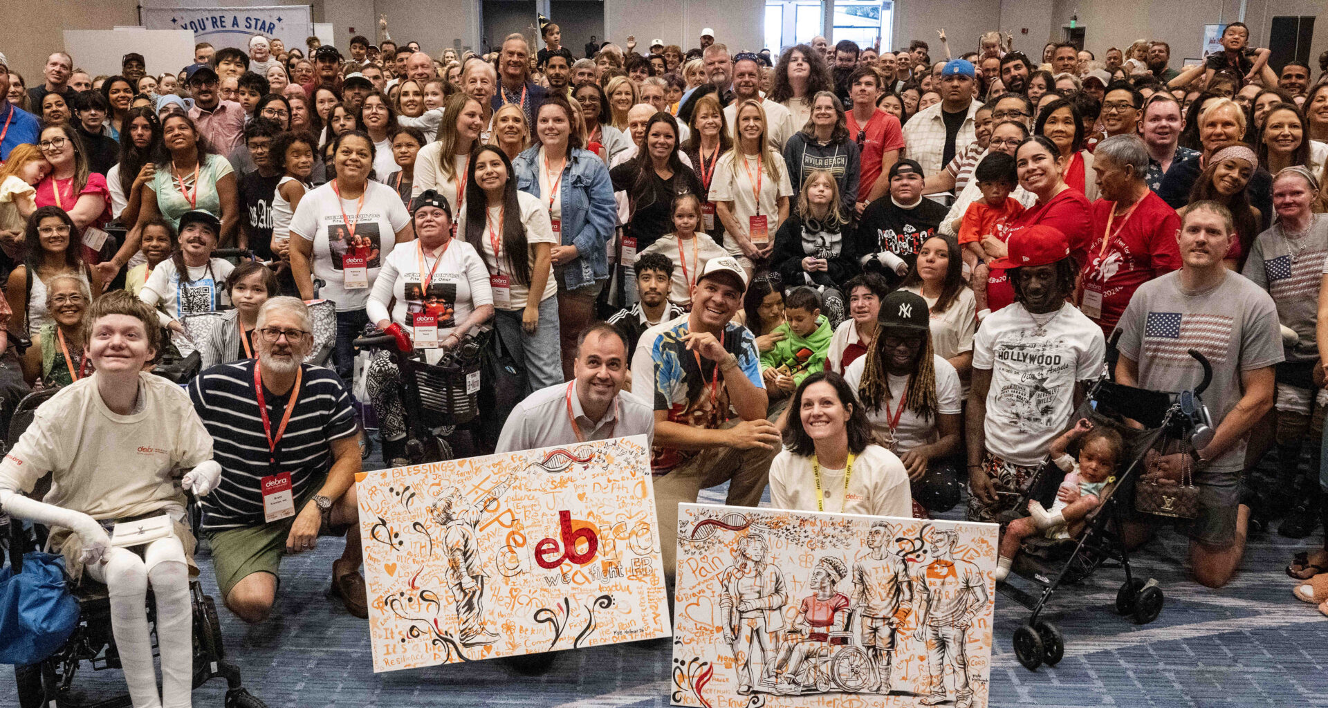 Murals to be auctioned to aid EB patients – Daily News