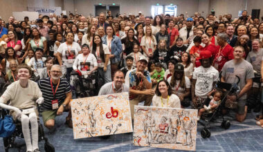 Murals to be auctioned to aid EB patients – Daily News