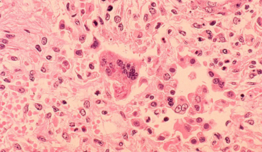 County health officials warn of possible measles exposure at LAX – NBC Los Angeles