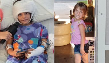 California girl, 7, left 'fighting for her life' after pack of dogs rip off her scalp, shred her legs