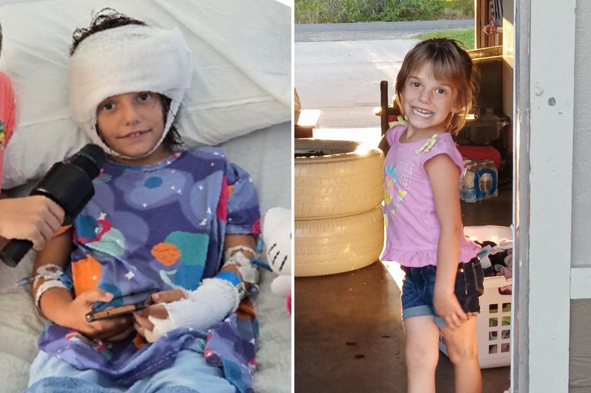 California girl, 7, left 'fighting for her life' after pack of dogs rip off her scalp, shred her legs