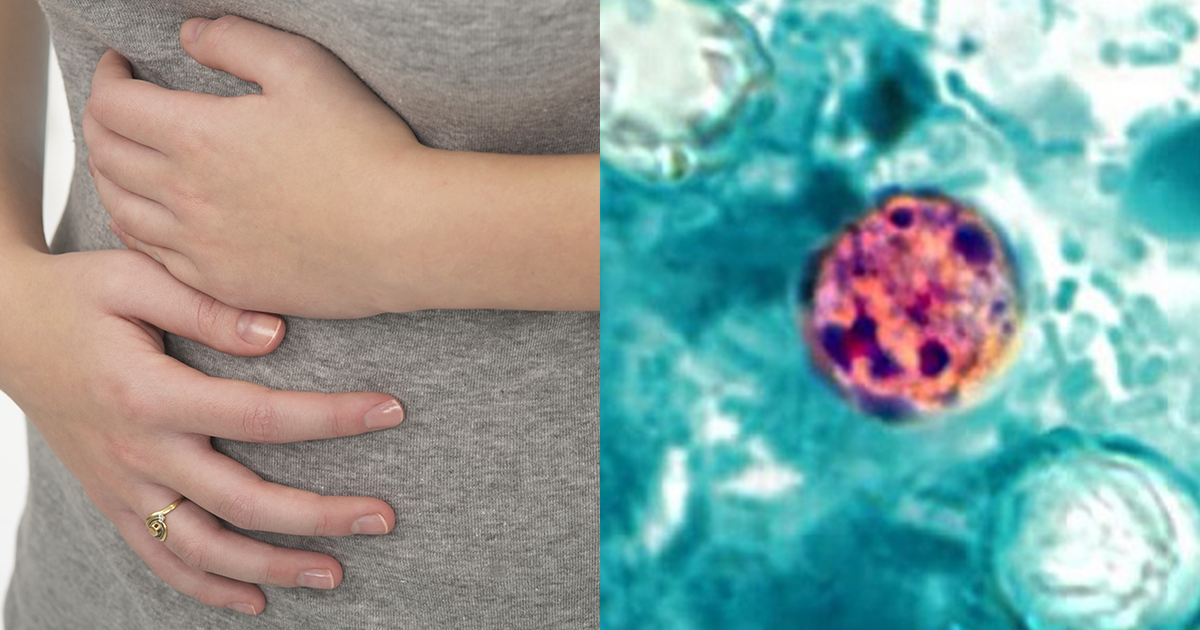 Cyclosporiasis: California now reporting cases of diarrheal illness
