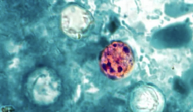 California largely avoids “explosive diarrhea” outbreak