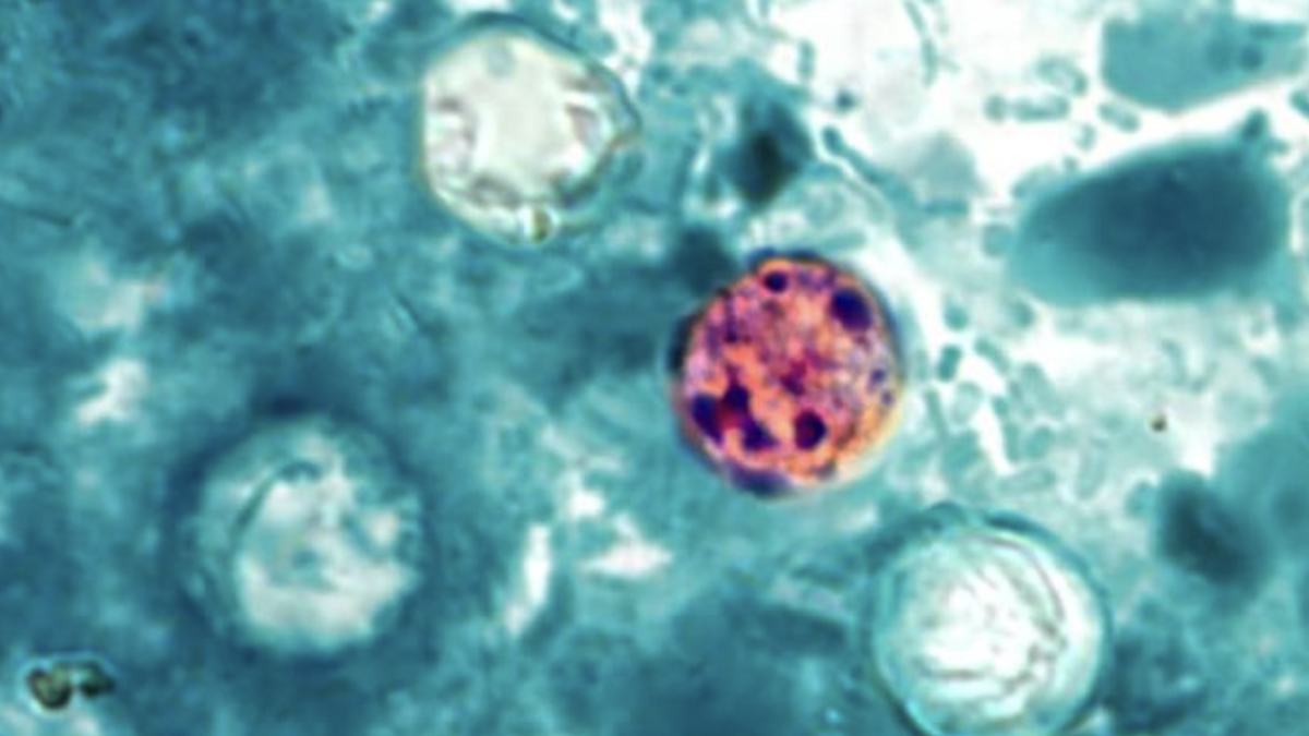 California largely avoids “explosive diarrhea” outbreak