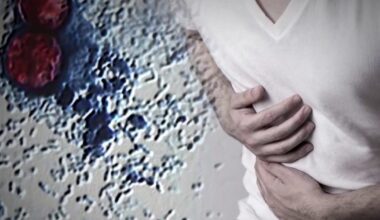 Cyclospora parasite causing 'explosive diarrhea' reaches California as US cases break records