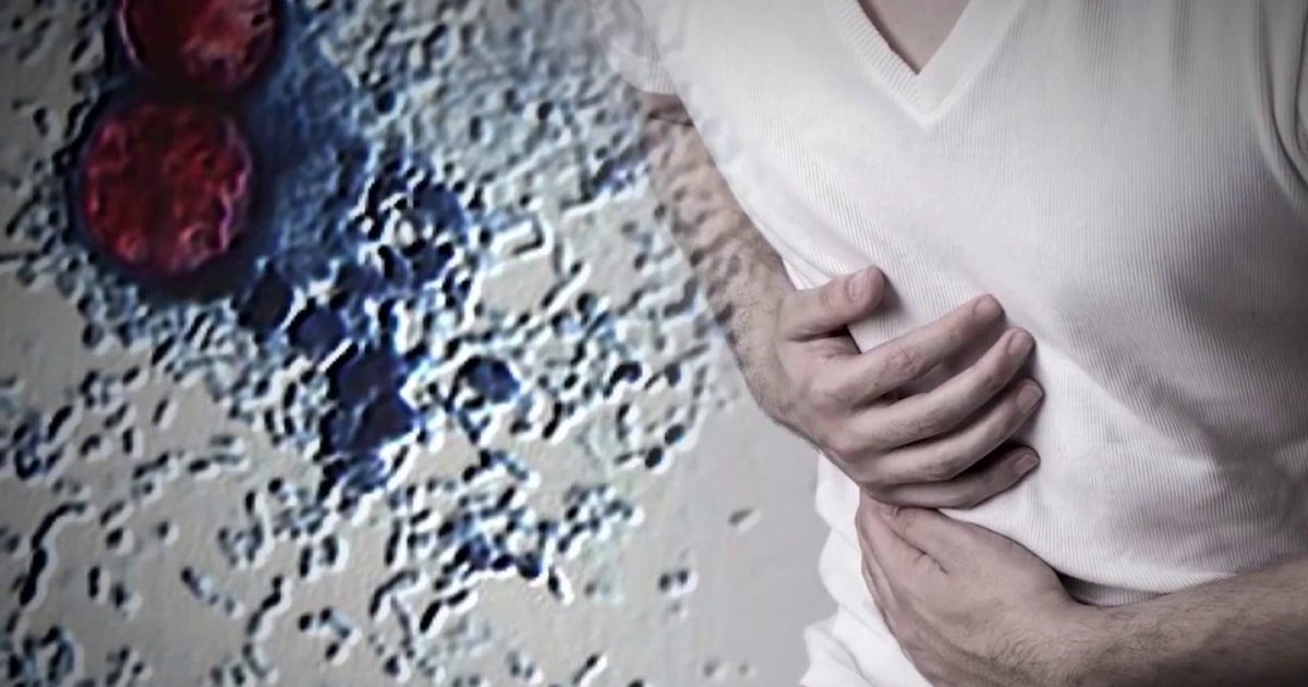 Cyclospora parasite causing 'explosive diarrhea' reaches California as US cases break records