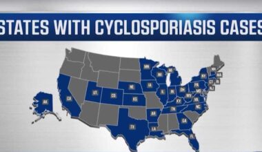 Cyclospora outbreak grows as California cases remain low
