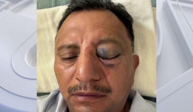 Long Beach paletero says he was brutally attacked while selling ice cream on July 4