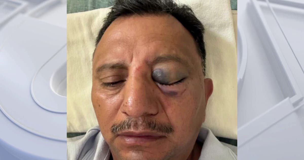 Long Beach paletero says he was brutally attacked while selling ice cream on July 4